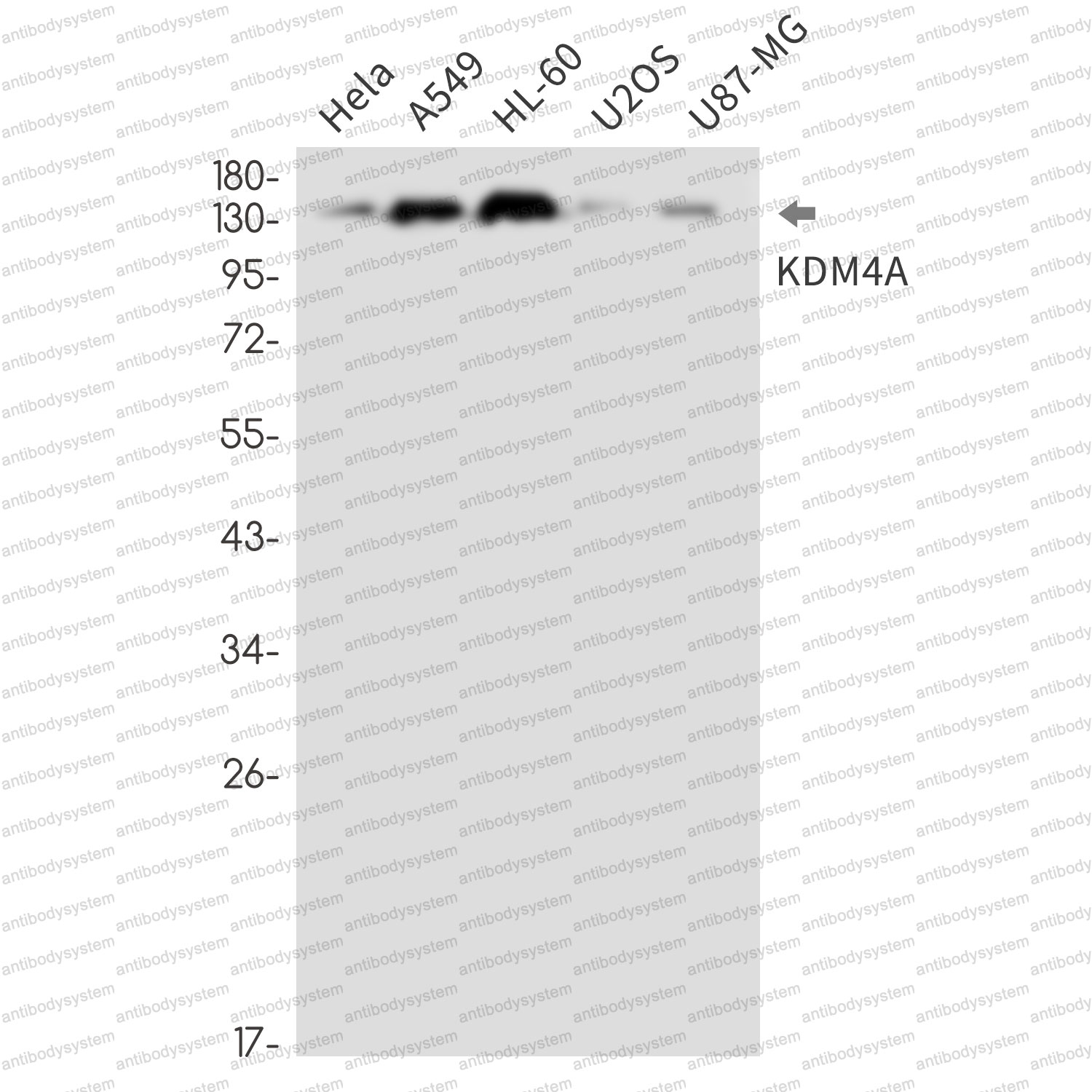 Anti-KDM4A Antibody (R1F09)