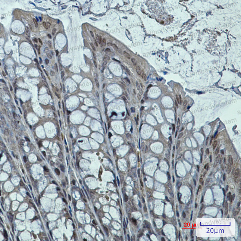 Anti-DNAJB6 Antibody (R1F10)