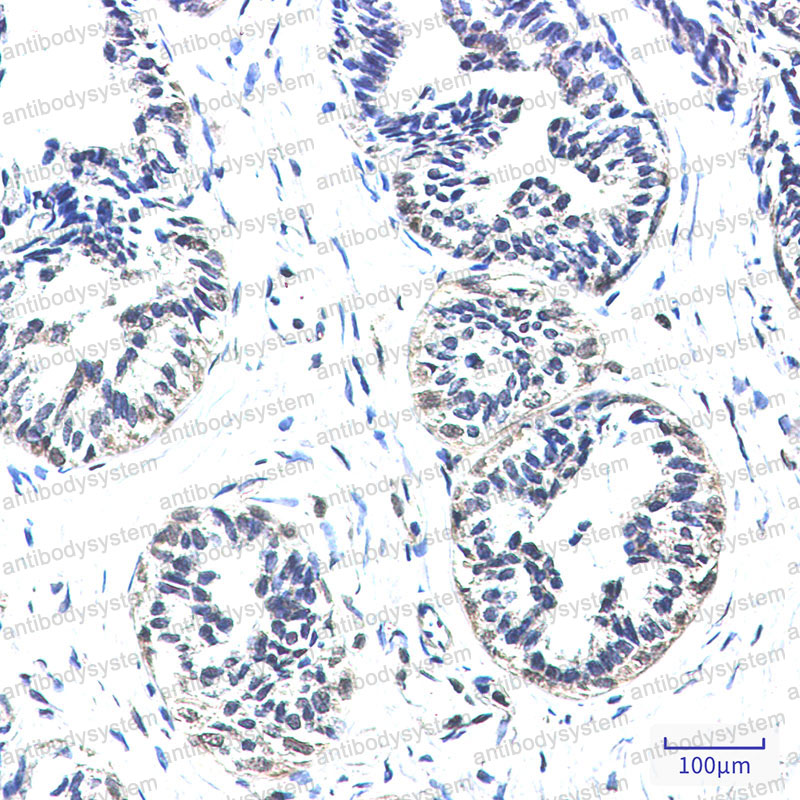 Anti-NDUFS2 Antibody (R1F12)
