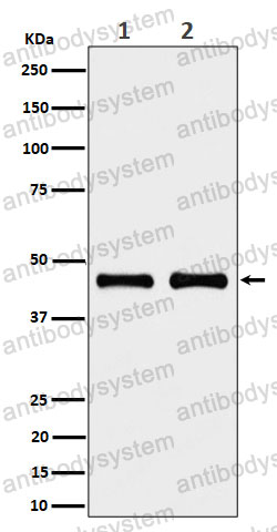 Anti-NDUFS2 Antibody (R1F11)