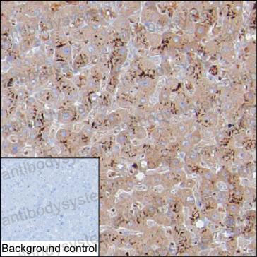 Anti-ZPR1 Antibody (R2V64)