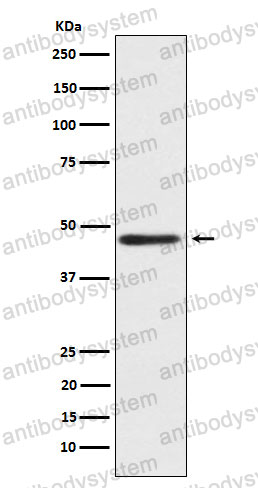 Anti-ENTPD5 Antibody (R1F18)