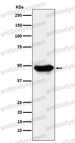 Anti-ENTPD5 Antibody (R1F17)