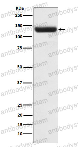 Anti-ZNF217 Antibody (R1F19)