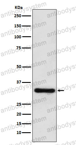Anti-PITX3 Antibody (R1F20)