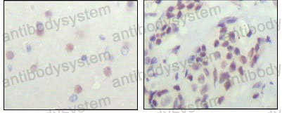Immunohistochemical for Anti-NCOR1 Antibody (R2V68) ?>