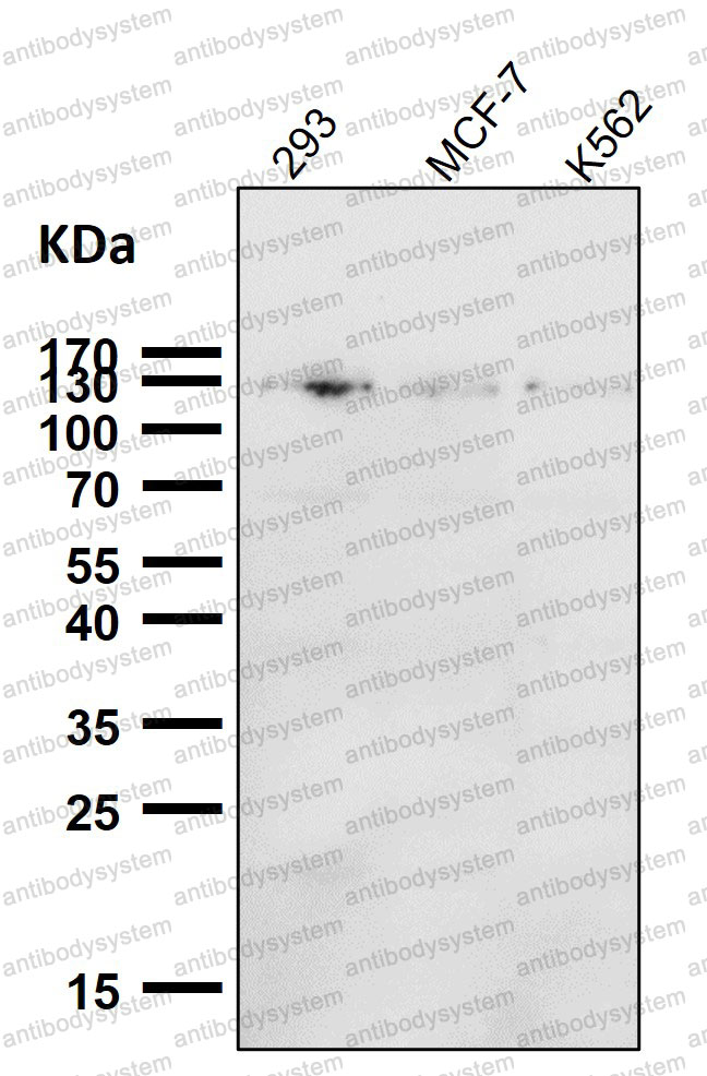 Anti-Phospho-ULK1 (S556) Antibody (R1B72)