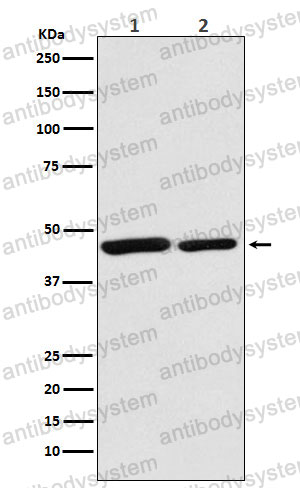Anti-CS Antibody (R1F27)