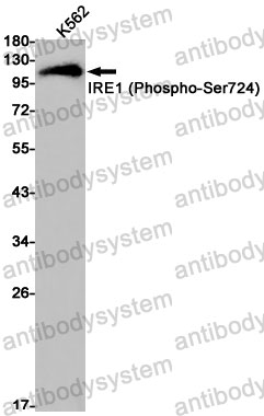 Anti-Phospho-ERN1/IRE1 (Ser724) Antibody (R1F36)