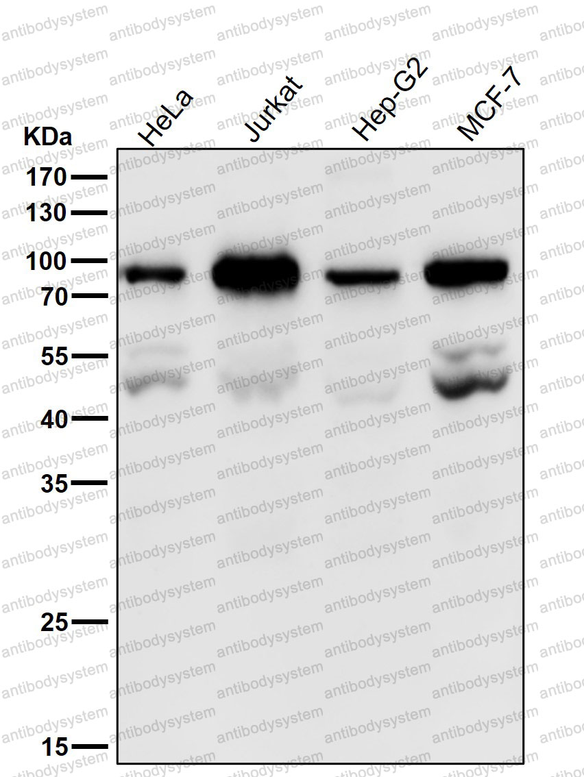 Anti-PSIP1 Antibody (R1B76)