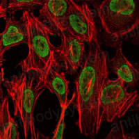 Immunofluorescence for Anti-PSIP1 Antibody (R2V74) ?>