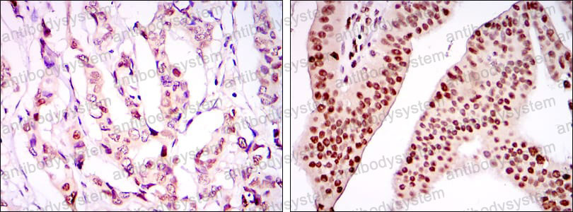Immunohistochemical for Anti-PSIP1 Antibody (R2V74) ?>