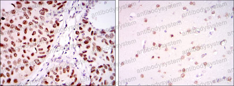 Immunohistochemical for Anti-PSIP1 Antibody (R2V74) ?>