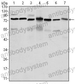 Western blot for Anti-PSIP1 Antibody (R2V74) ?>
