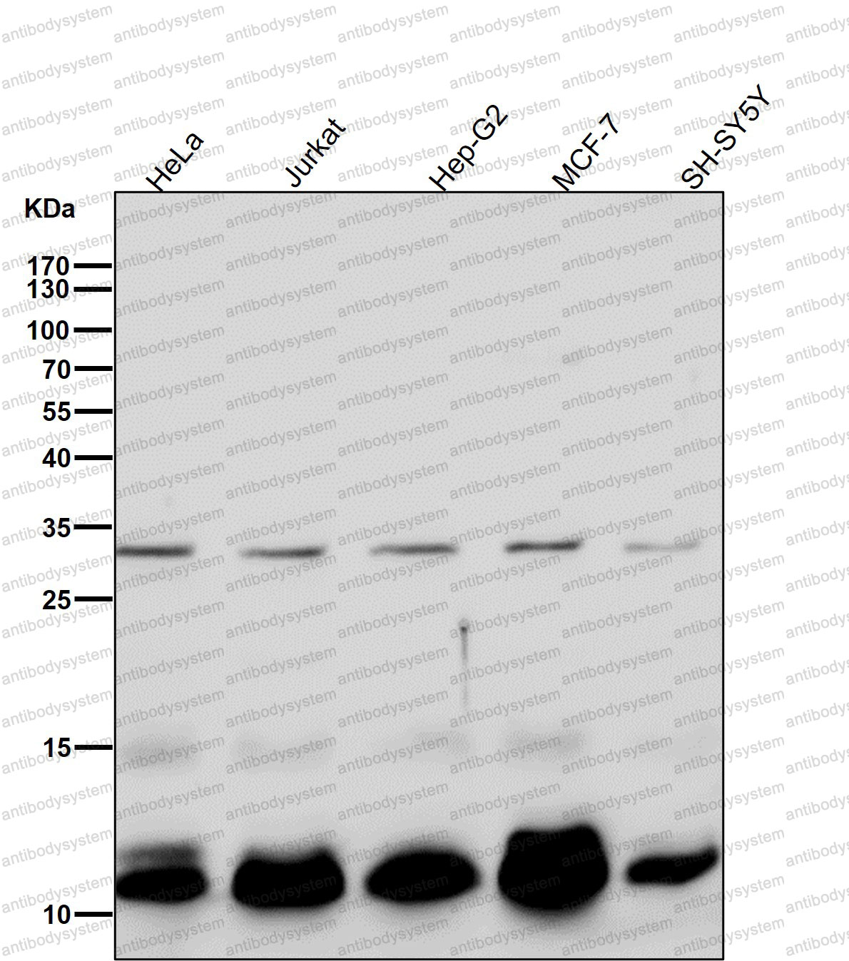 Anti-BANF1 Antibody (R1F44)