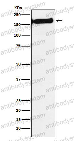 Anti-SF3B1 Antibody (R1F46)