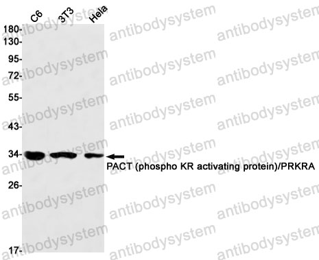 Anti-PRKRA Antibody (R1F53)