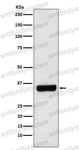 Anti-PRKRA Antibody (R1F52)