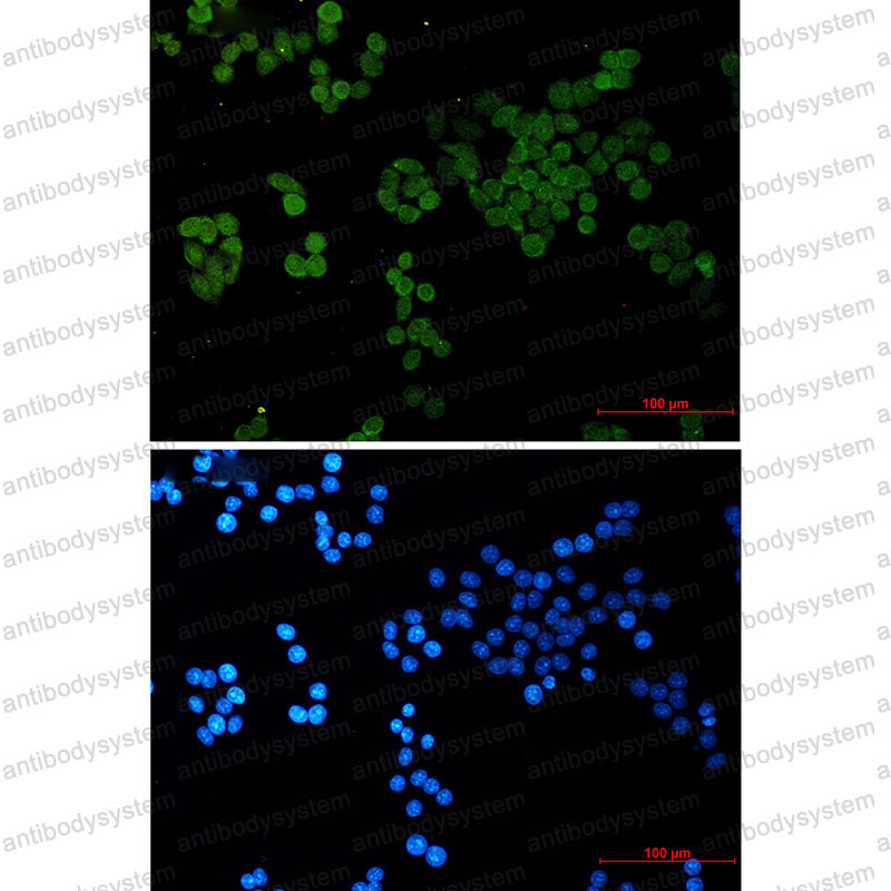 Anti-CRCP Antibody (R1F55)