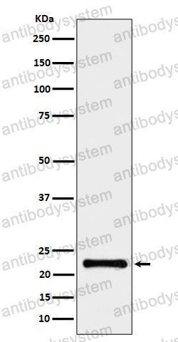 Anti-CRCP Antibody (R1F54)