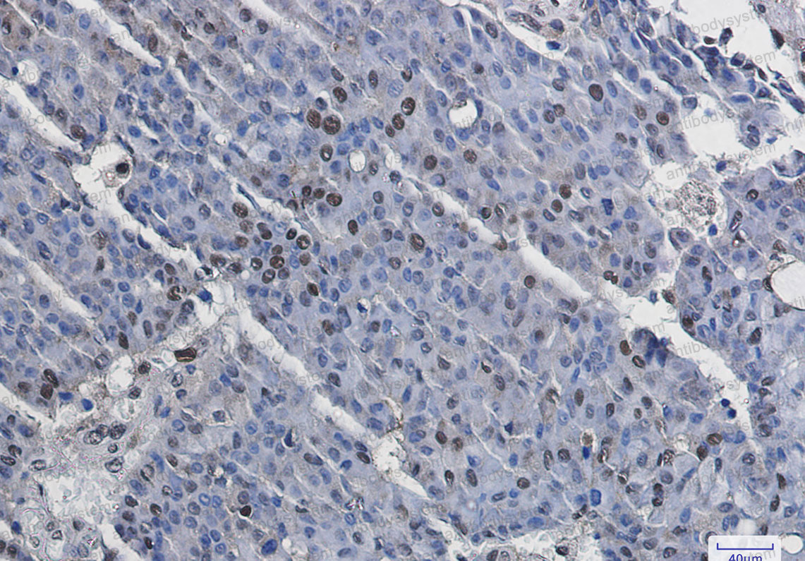 Anti-Phospho-RPS6KA5/MSK1 (Ser376) Antibody (R1F58)