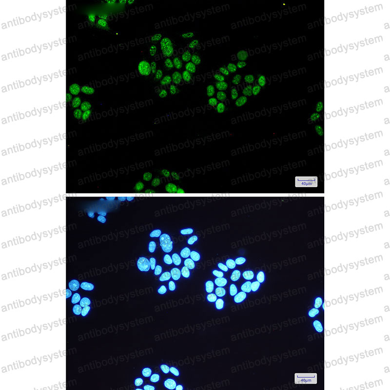 Anti-Phospho-RPS6KA5/MSK1 (Ser360) Antibody (R1F57)