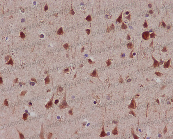 Anti-Phospho-RPS6KA5/MSK1 (S376) Antibody (R1F56)