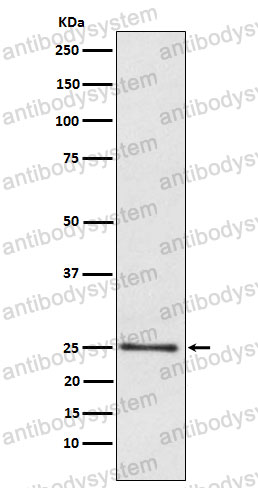 Anti-LYPLA1 Antibody (R1F59)