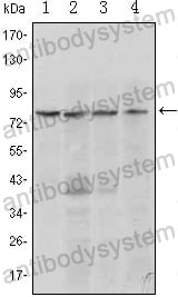Western blot for Anti-PRDM1 Antibody (R2V84) ?>