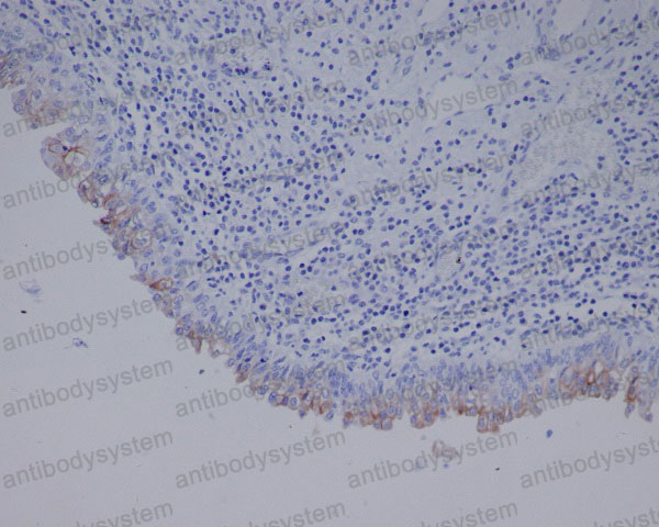 Anti-UPK3A Antibody (R1F60)