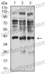 Western blot for Anti-ADAP1 Antibody (R2V87) ?>