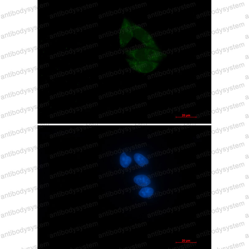 Anti-NUP155 Antibody (R1F62)