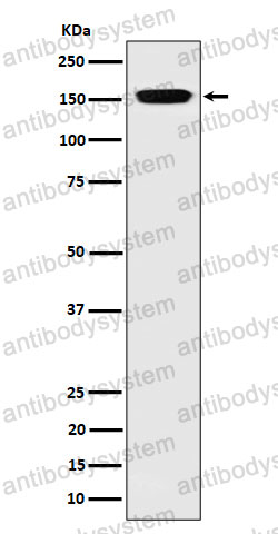 Anti-NUP155 Antibody (R1F61)