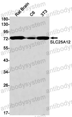 Anti-SLC25A12 Antibody (R1F64)