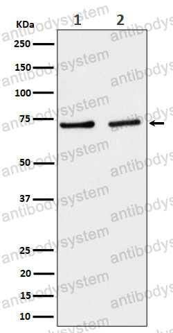 Anti-SLC25A12 Antibody (R1F63)