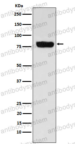 Anti-SLC22A3 Antibody (R1F65)