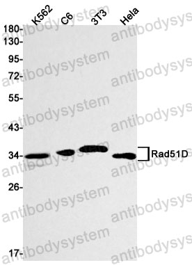 Anti-RAD51D Antibody (R1F67)