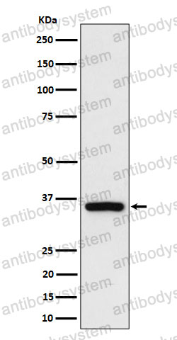 Anti-RAD51D Antibody (R1F66)
