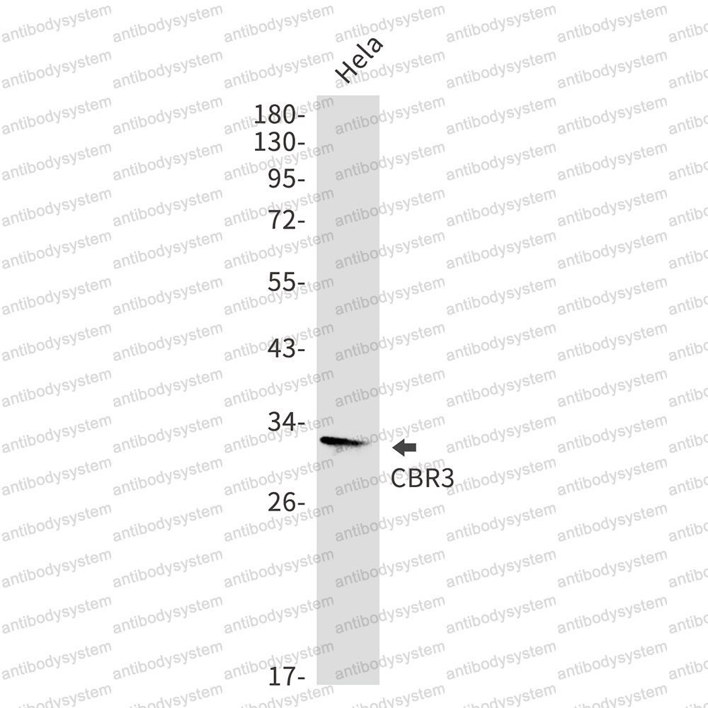 Anti-CBR3 Antibody (R1F70)