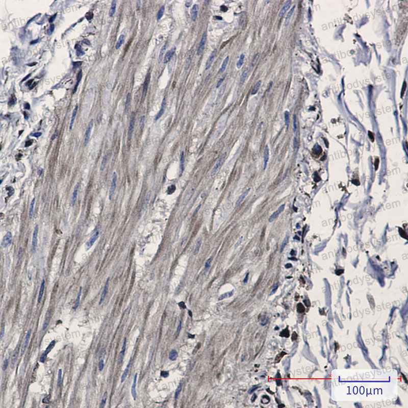 Anti-IDH1 Antibody (R1F71)