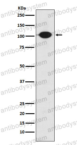 Anti-GABBR2 Antibody (R1F73)