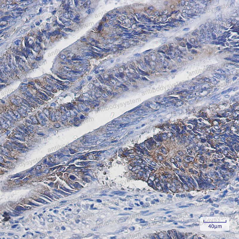 Anti-DGAT1 Antibody (R1F75)