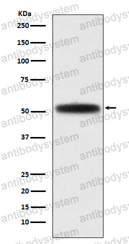Anti-DGAT1 Antibody (R1F74)