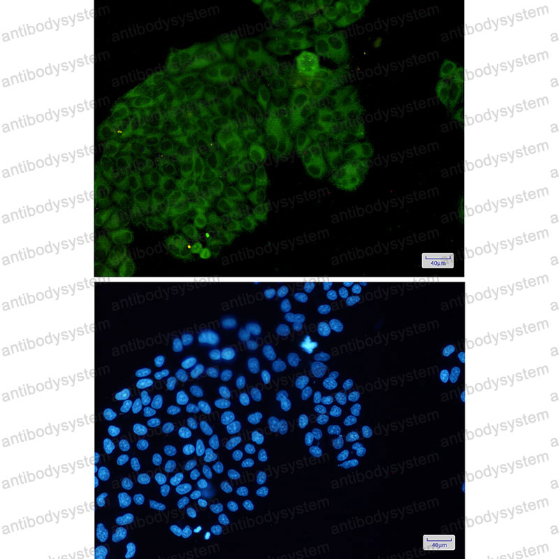 Anti-Phospho-PAK1/2/3 (Ser144/Ser141/Ser154) Antibody (R1F76)