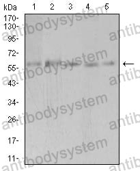 Anti-PAK3 Antibody (R2V97)