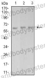 Anti-PAK3 Antibody (R2V98)