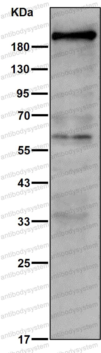 Anti-DYSF/Dysferlin Antibody (R1F77)