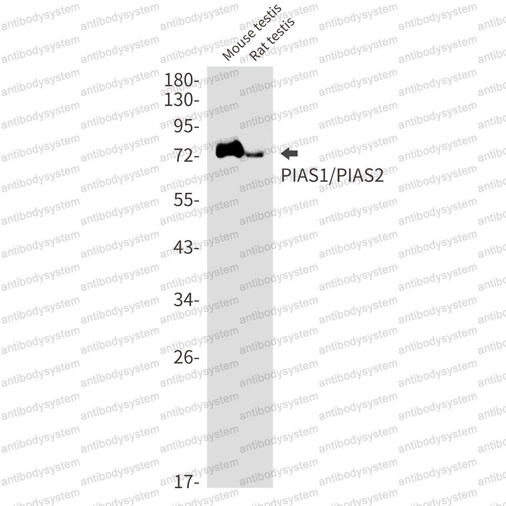 Anti-PIAS1/2 Antibody (R1F80)