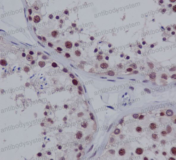Anti-PIAS1 Antibody (R1F78)