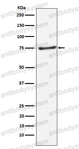 Anti-PIAS1 Antibody (R1F79)